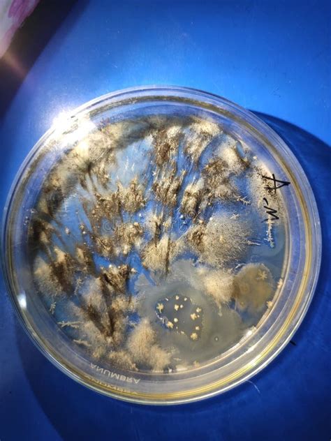 Aspergillus Niger Fumigatus Colony On Saboraud Dextrose Agar Medium