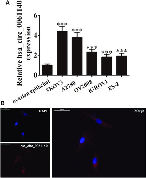 Expression And Subcellular Localization Of Hsa Circ 0061140 In Ovarian