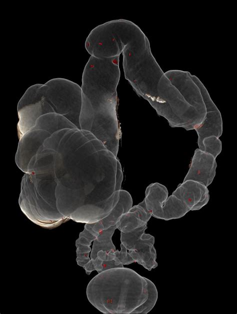 Colon Intubation Morphology Of The Colon And Endoscopic Intubation Colon Explorer