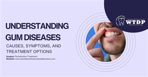 Understanding Gum Disease Causes Symptoms And Treatment Options