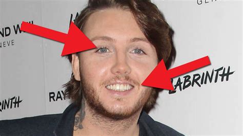 Is James Arthur Wearing Lip Gloss And Mascara The Singers Slap Up