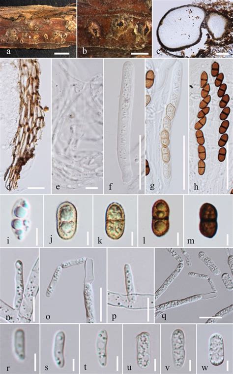 Valsaria Ostryae Facesoffungi Number Fof 04614 Faces Of Fungi