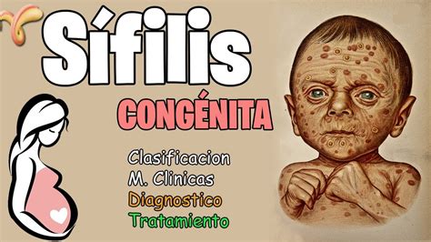 SÍfilis Congenita SÍfilis Y Embarazo Clasificación Clinica Diagnostico Y Tratamiento Youtube