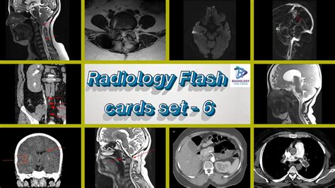 Radiology Flash Cards Set Dr Gowthami Chebrolu Dr Uma Maheshwara