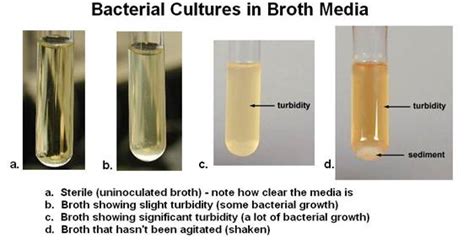 Microbiology Liquid Broth Diets - jtpriority