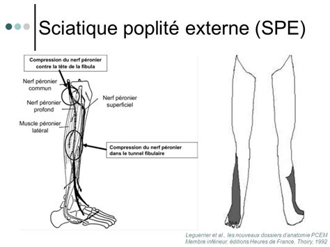 Syndromes Canalaires Des Membres Inferieurs Ppt T L Charger