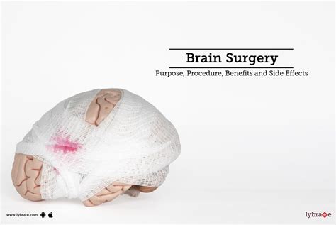 Brain Surgery: Purpose, Procedure, and Benefits and Side Effects