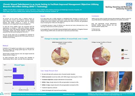 Accelerating Wound Healing In Chronic Wound And Post Surgical Wound