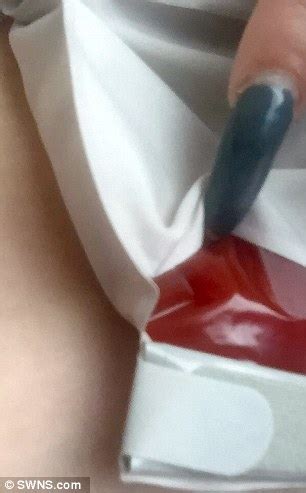 Woman Is Left With Wonky Chest After Two Botched Boob Job Operations Abroad Daily Mail Online