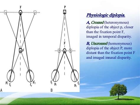 Binocular Vision And Vision Perception