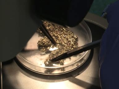 visualizing rna localization in xenopus oocytes 