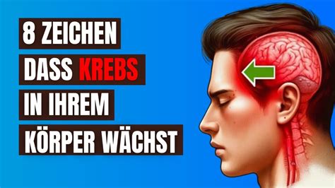 Vernachlässigen Sie Nicht Diese 8 Frühen Anzeichen von Krebs Sie