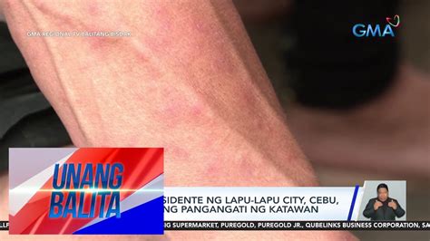 Mahigit 100 Residente Ng Lapu Lapu City Cebu Nakararanas Ng