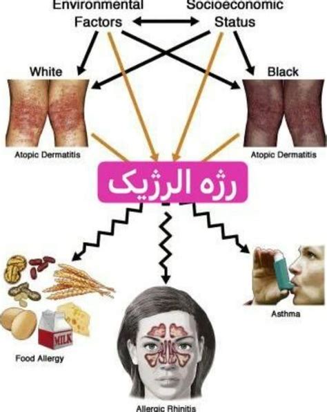 درمان آلرژی کلینیک آلرژی دکتر اصغریان