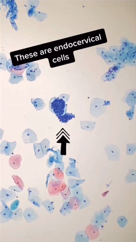 uknoshamsand on Instagram: Endocervical cells #cells #cytology # ...