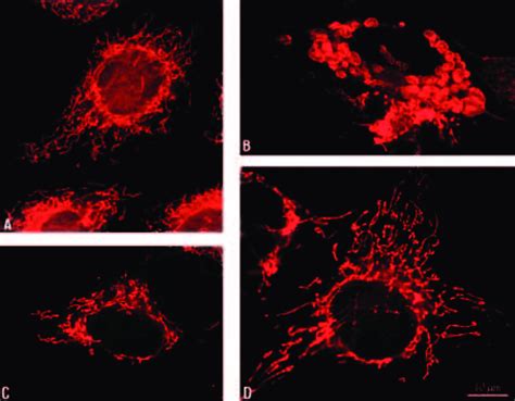 Morphological Changes Of Mitochondria In 143B Cells Cells Were Treated