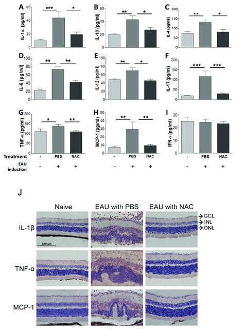 The Influence Of Nac Treatment On The Levels Of Inflammatory Mediators