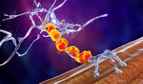 Advances in Motor neuron disease treatments