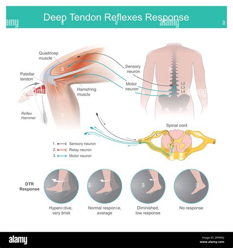 Deep tendon reflex Cut Out Stock Images & Pictures - Alamy