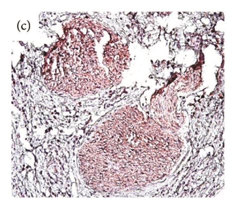 Representative Photomicrograph Of Immunohistochemistry CD44 Expression