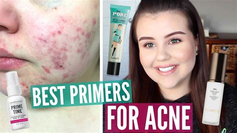 Best Face Primers For Acne My Top 5 Face Primers Youtube