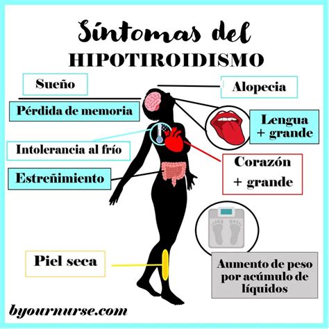 Hipotiroidismo Byournurse