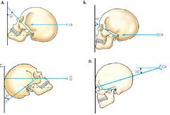 Study Quiz Facial And Nasal Bones Quizlet