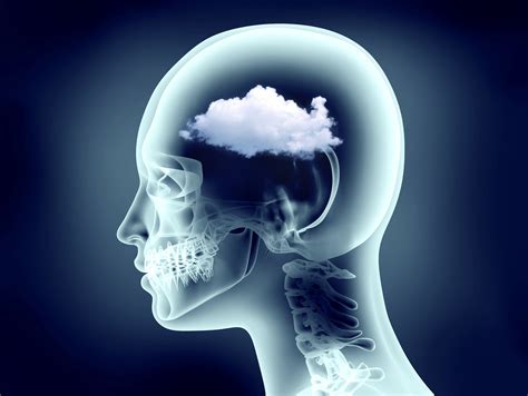 Brain Fog Icd 10 1