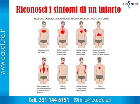 Quali Sono I Sintomi Dellinfarto E Come Riconoscerli Doctorium Sexiz Pix