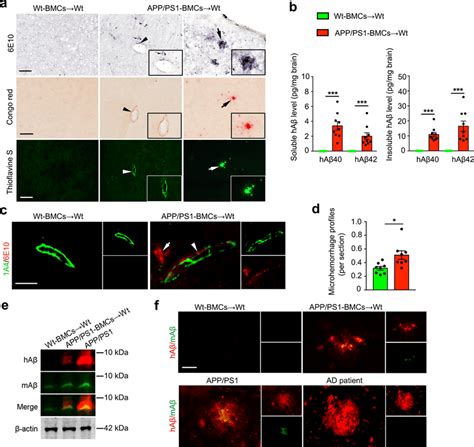 Brain A Deposition And Cerebral Amyloid Angiopathy Caa In Wild Type