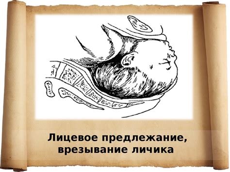 Разгибательные предлежания головки плода - презентация онлайн