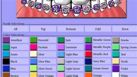 Color Choosing Braces Youtube