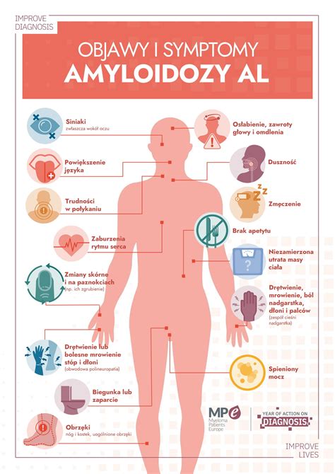 Czym jest amyloidoza AL jej objawy i symptomy Polska Sieć Amyloidozy