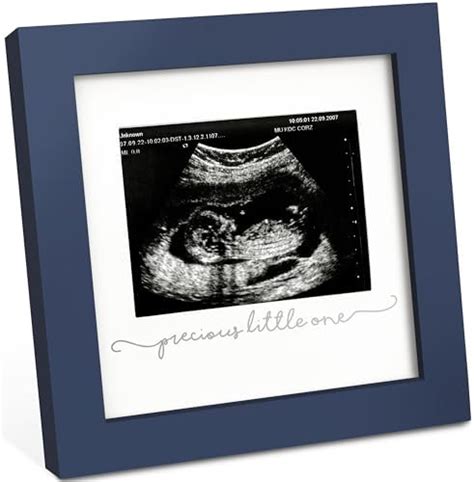 Amazon Juvale White Sonogram Keepsake Frame For X Ultrasound