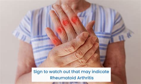 Signs To Watch Out That May Indicate Rheumatoid Arthritis Kle Hospital