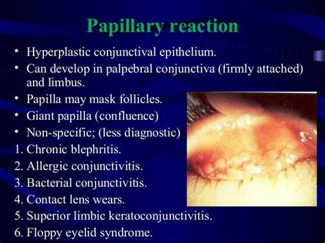 Conjunctiva anatomy and physiology