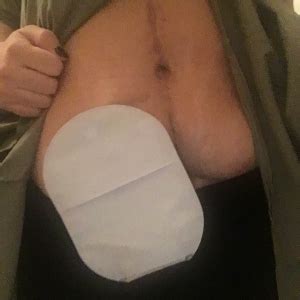 Scars How I Overcame My Insecurities By Going Naked So Bad Ass