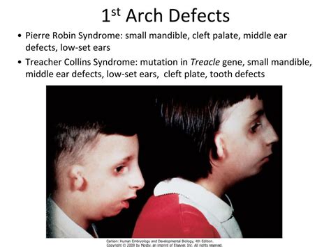 Ppt Craniofacial And Pharyngeal Arch Development Powerpoint
