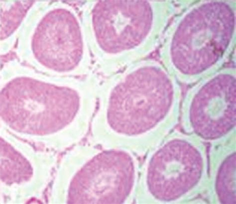 Histopathological Investigations Of The Testicular Tissues With