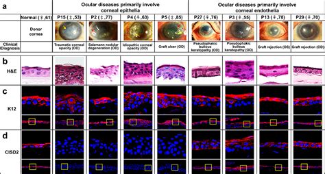 Corneal Epithelium Layers