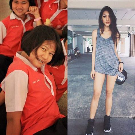 Hot girl bốc lửa Thái Lan bất ngờ công khai ảnh phẫu thuật để có eo con kiến điều đáng nói đây