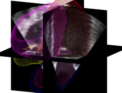 Ultrasound Tissue Characterization Laboratorio De Procesado De Imagen