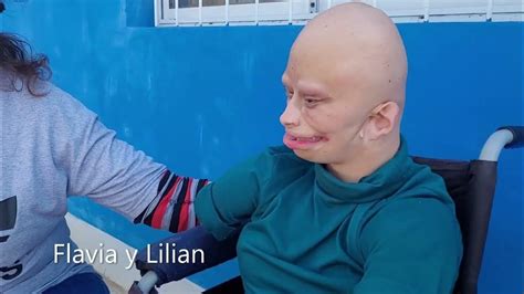 La Enorme Insensibilidad Del Intendente Lilian Tiene 12 Años Nació