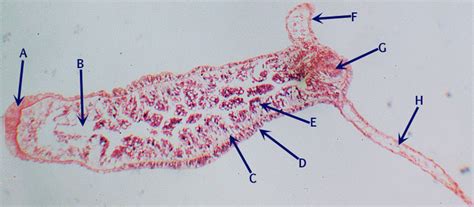 Cnidarians Flatworms And Gastrotrichs Diagram Quizlet