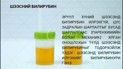 Шээсний ерөнхий шинжилгээ - YouTube