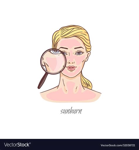 Sunburn Cartoon Girl