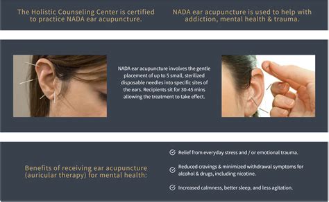 Ear Acupuncture Addiction Points At Michael Recio Blog