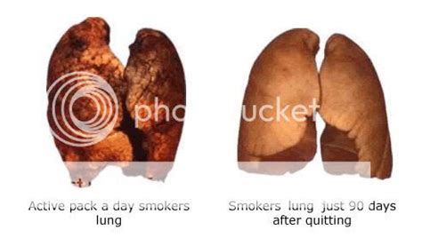 Before and after smoking lungs - Before - After Pictures, women, men