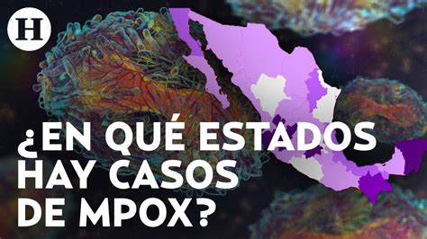 Casos De Mpox En M Xico Situaci N Actual Y Medidas Preventivas