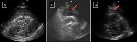 Ultrasonido A La Cabecera Del Paciente Una Herramienta Diagnóstica De